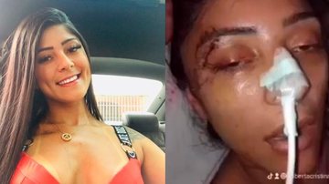 Andressa teve traumatismo craniano encefálico e uma lesão disseminada nos axônios Pedido de ajuda após agressão - Reprodução arquivo pessoal