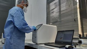 Imagem Pesquisadores da Fiocruz criam método para detectar hepatite D