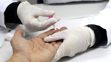 Teste rápido de sífilis e HIV pode ser realizado gratuitamente em Praia Grande Teste rápido de sífilis e HIV - Divulgação/Unaerp