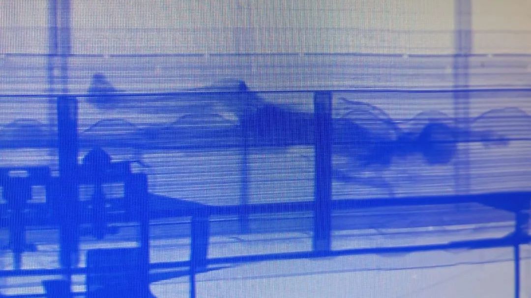 imagens de raio x mostram silhueta de corpo humano