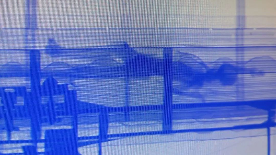 imagens de raio x mostram silhueta de corpo humano