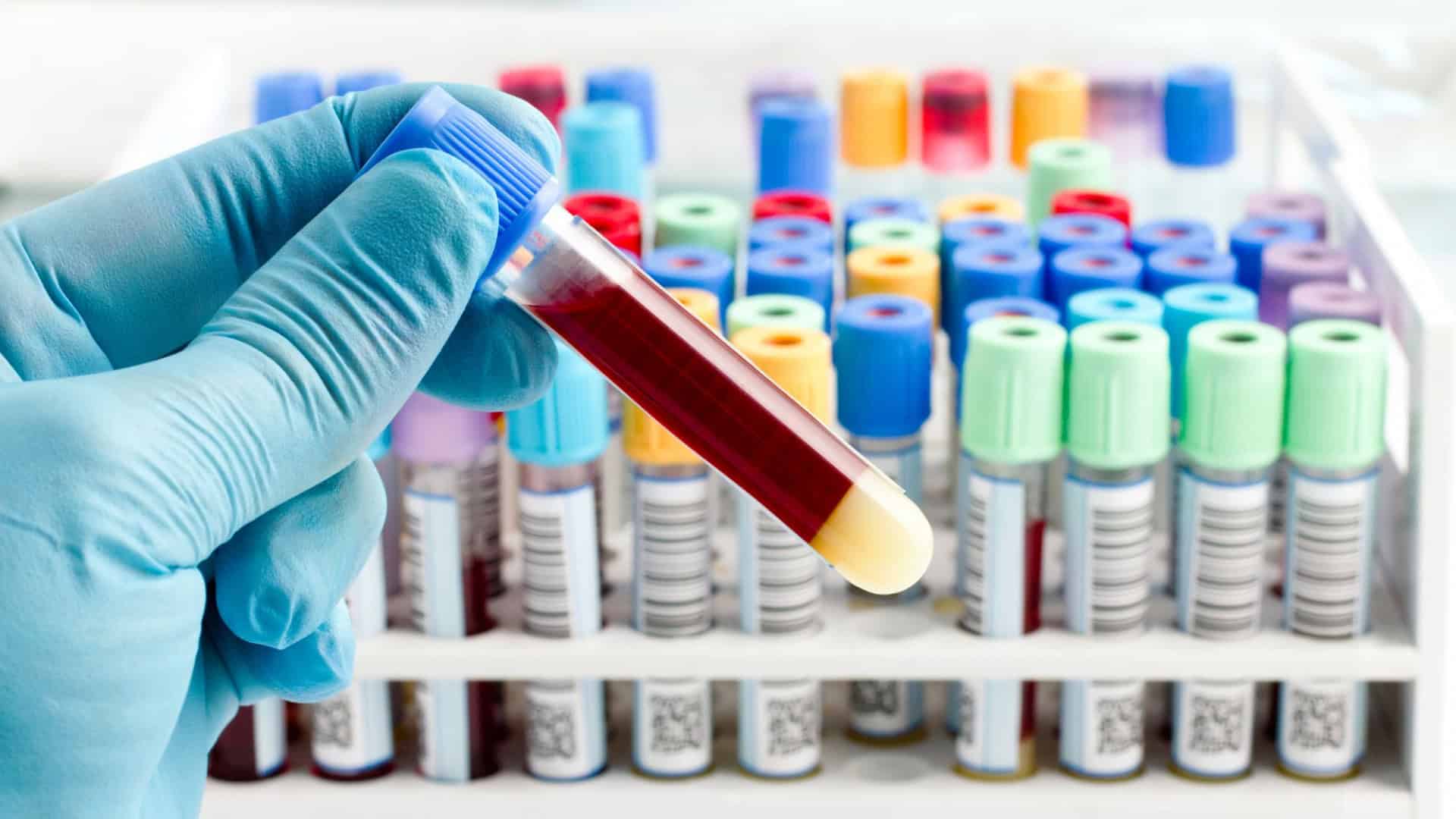 coleta sangue