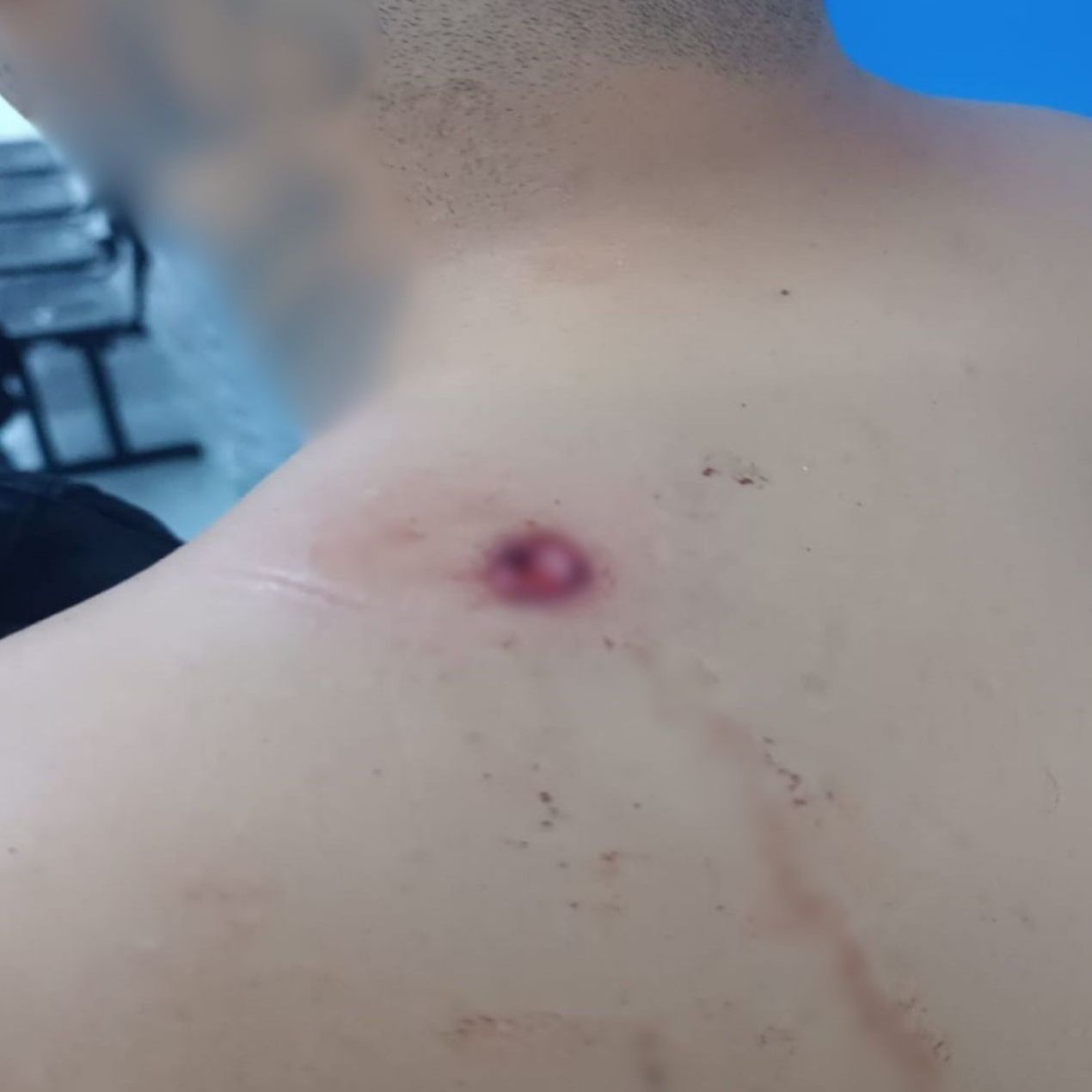 Jovem é baleado em frente a adega no centro de Ubatuba
